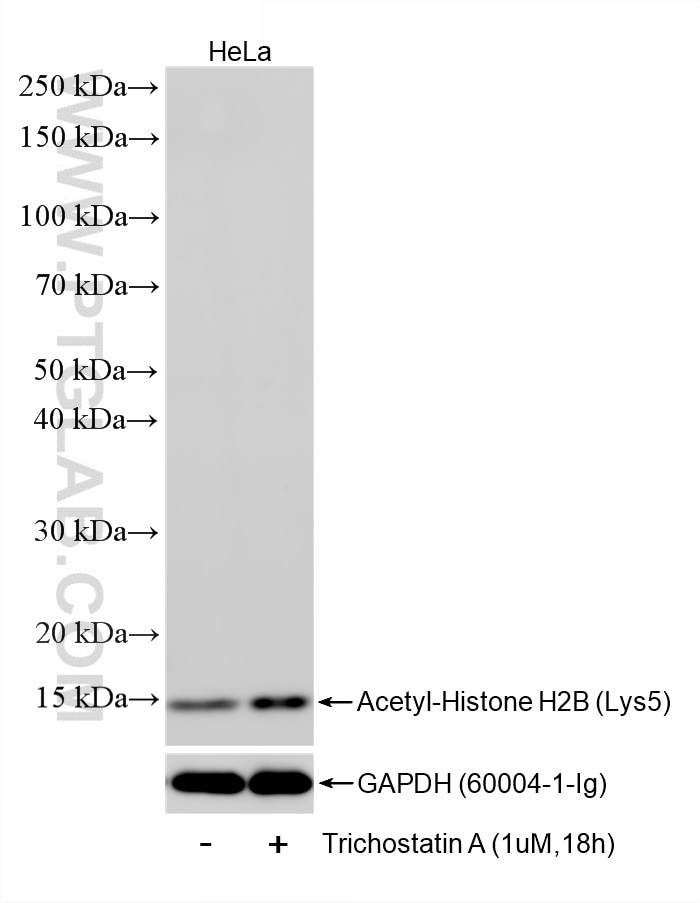 WB analysis of HeLa using 86731-1-RR (same clone as 86731-1-PBS) Western Blot (WB) analysis of HeLa cells using Acetyl-Histone H2B (Lys12) Recombinant monoclonal (86731-1-RR)