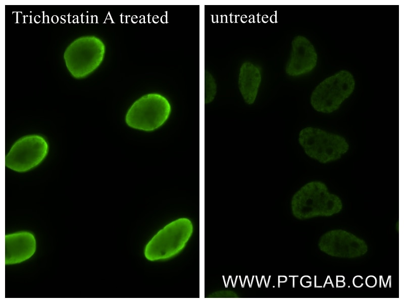 Immunofluorescence (IF) / fluorescent staining of HeLa cells using Acetyl-Histone H2B (Lys15) Recombinant monoclonal  (83171-7-RR)