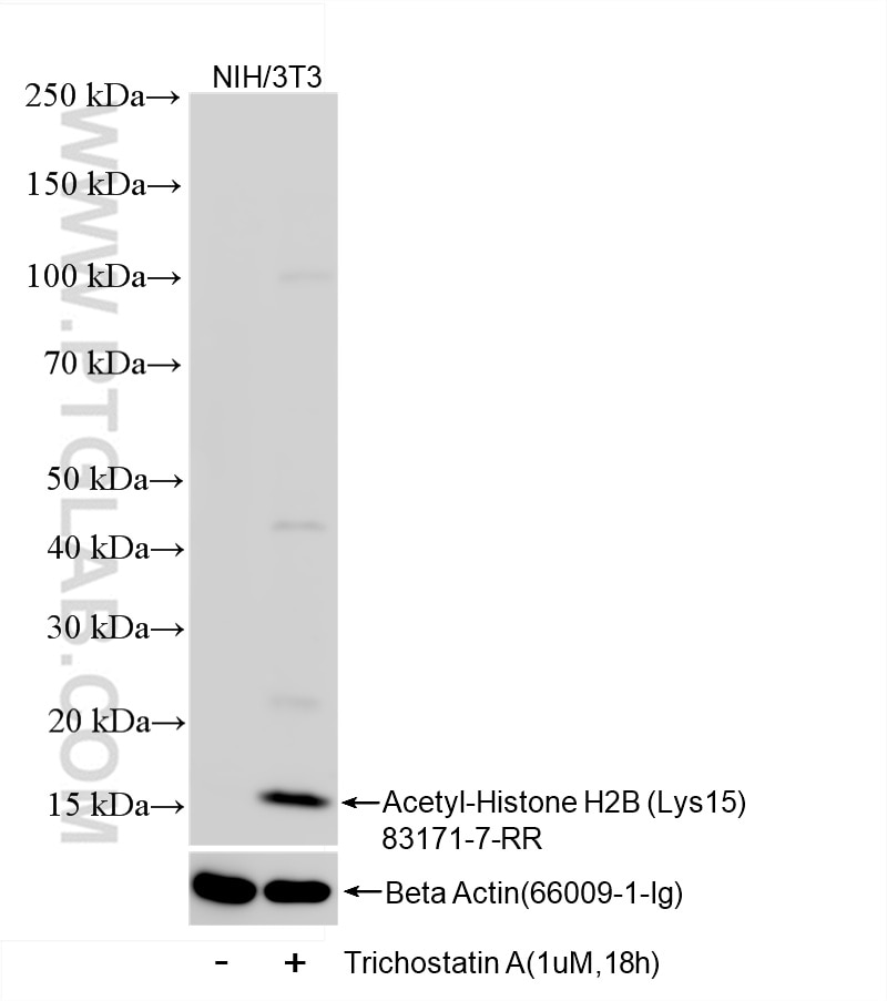 Acetyl-Histone H2B (Lys15)