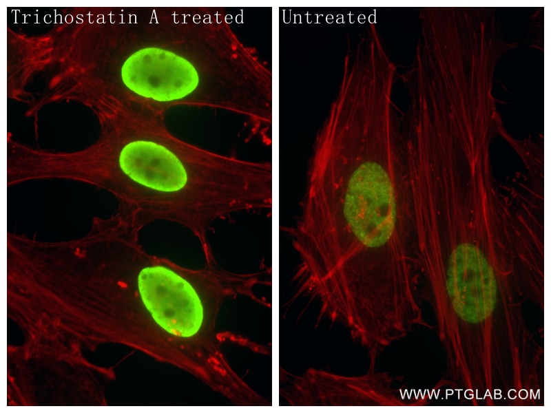 Immunofluorescence (IF) / fluorescent staining of HeLa cells using Acetyl-Histone H2B (Lys16) Recombinant antibody (84446-1-RR)