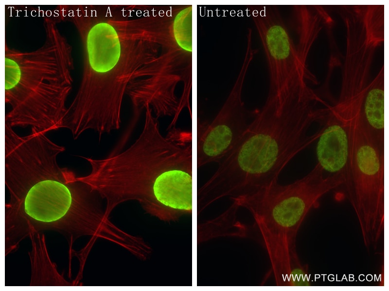 Immunofluorescence (IF) / fluorescent staining of NIH/3T3 cells using Acetyl-Histone H2B (Lys16) Recombinant antibody (84446-1-RR)