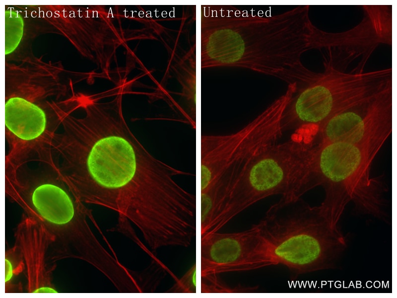 Immunofluorescence (IF) / fluorescent staining of NIH/3T3 cells using Acetyl-Histone H2B (Lys16) Recombinant antibody (84446-2-RR)