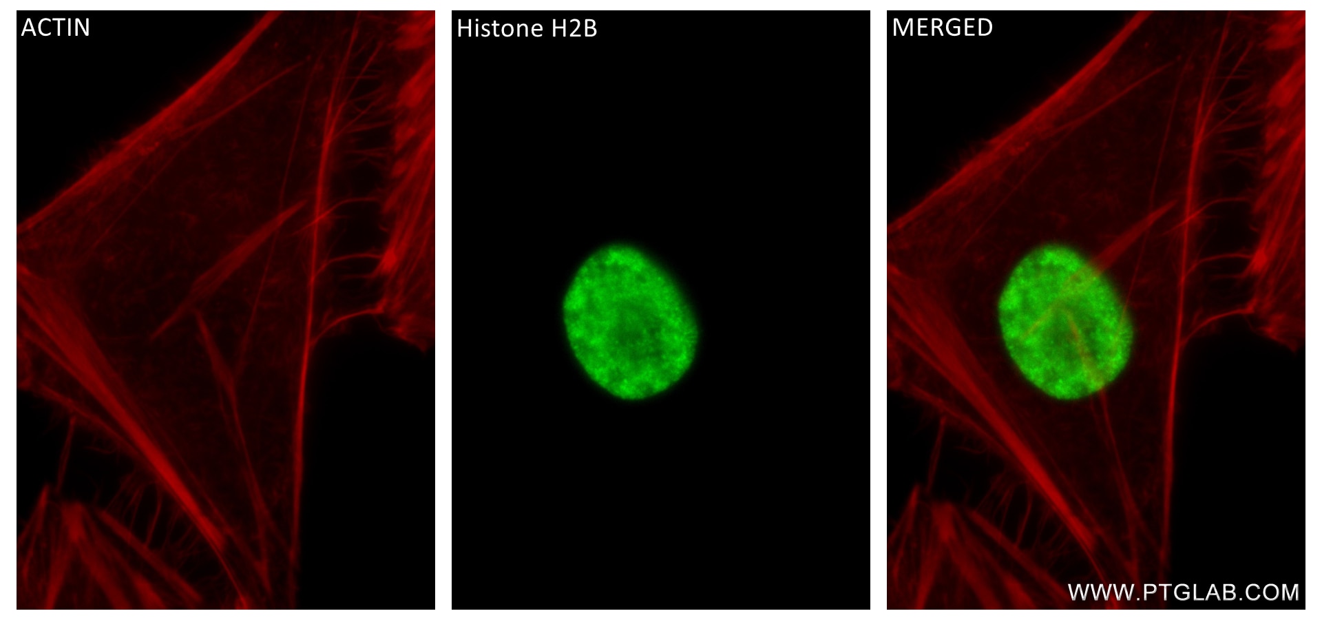 Acetyl-Histone H2B (Lys20)
