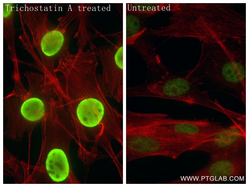 Immunofluorescence (IF) / fluorescent staining of NIH/3T3 cells using Acetyl-Histone H2B (Lys20) Recombinant antibody (84549-1-RR)