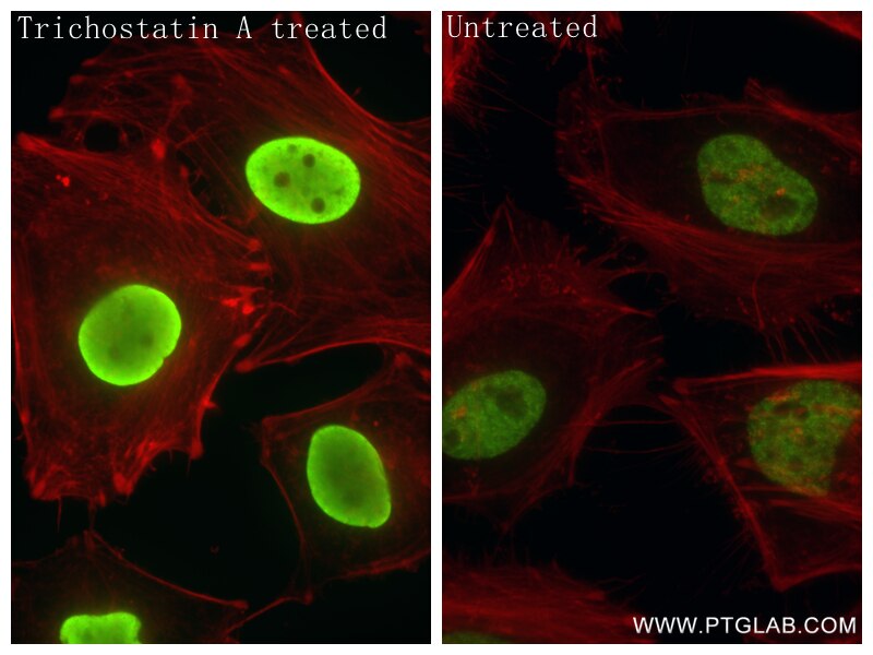 Immunofluorescence (IF) / fluorescent staining of HeLa cells using Acetyl-Histone H2B (Lys20) Recombinant antibody (84549-1-RR)