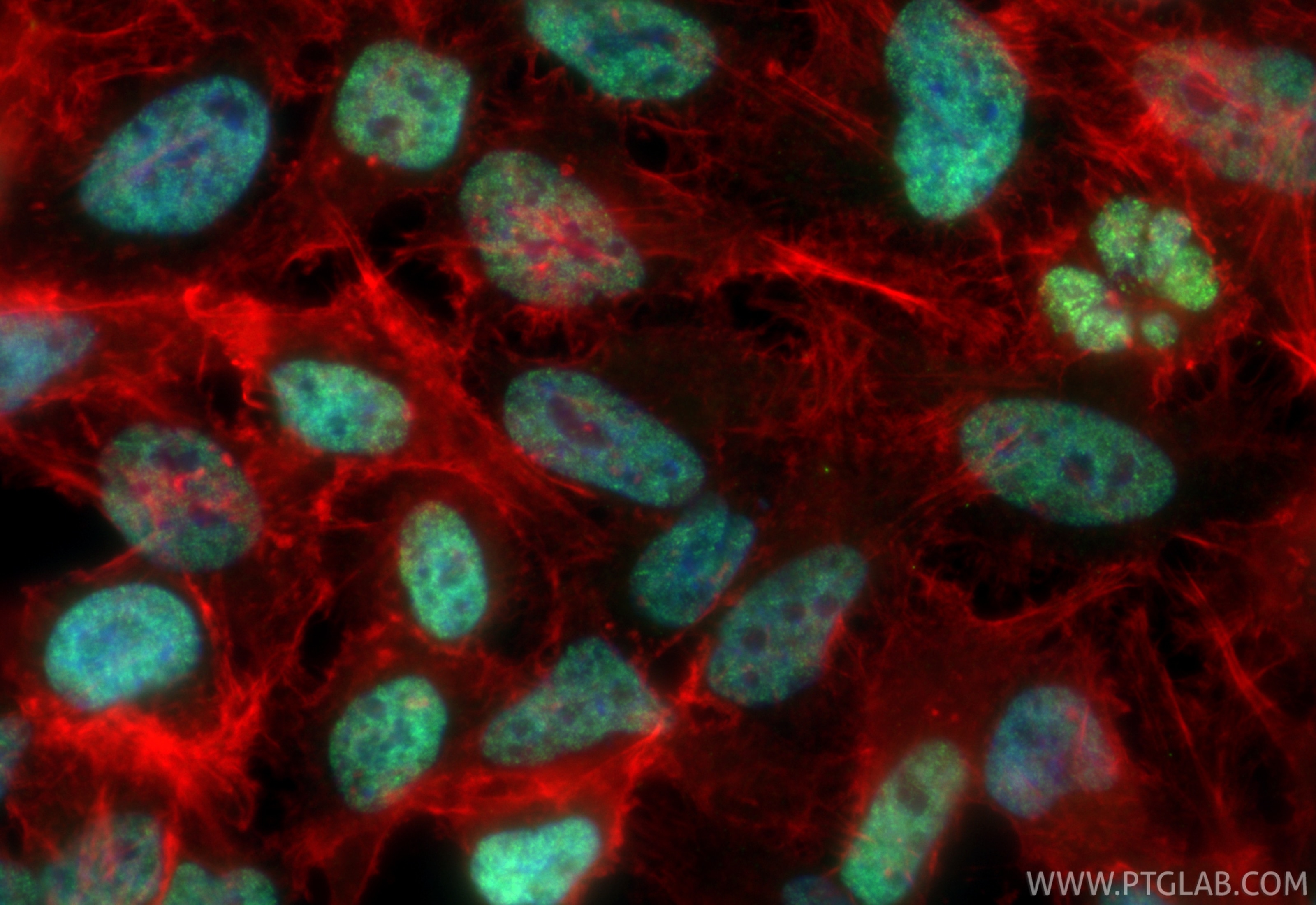 Immunofluorescent analysis of (4% PFA) fixed HeLa cells using CoraLite® Plus 488 Acetyl-Histone H2B (Lys20) antibody (CL488-84549, Clone: 241204H8 ) at dilution of 1:200, CL594-Phalloidin (red). Immunofluorescence (IF) / fluorescent staining of HeLa cells using CoraLite® Plus 488-conjugated Acetyl-Histone H2B ( (CL488-84549)