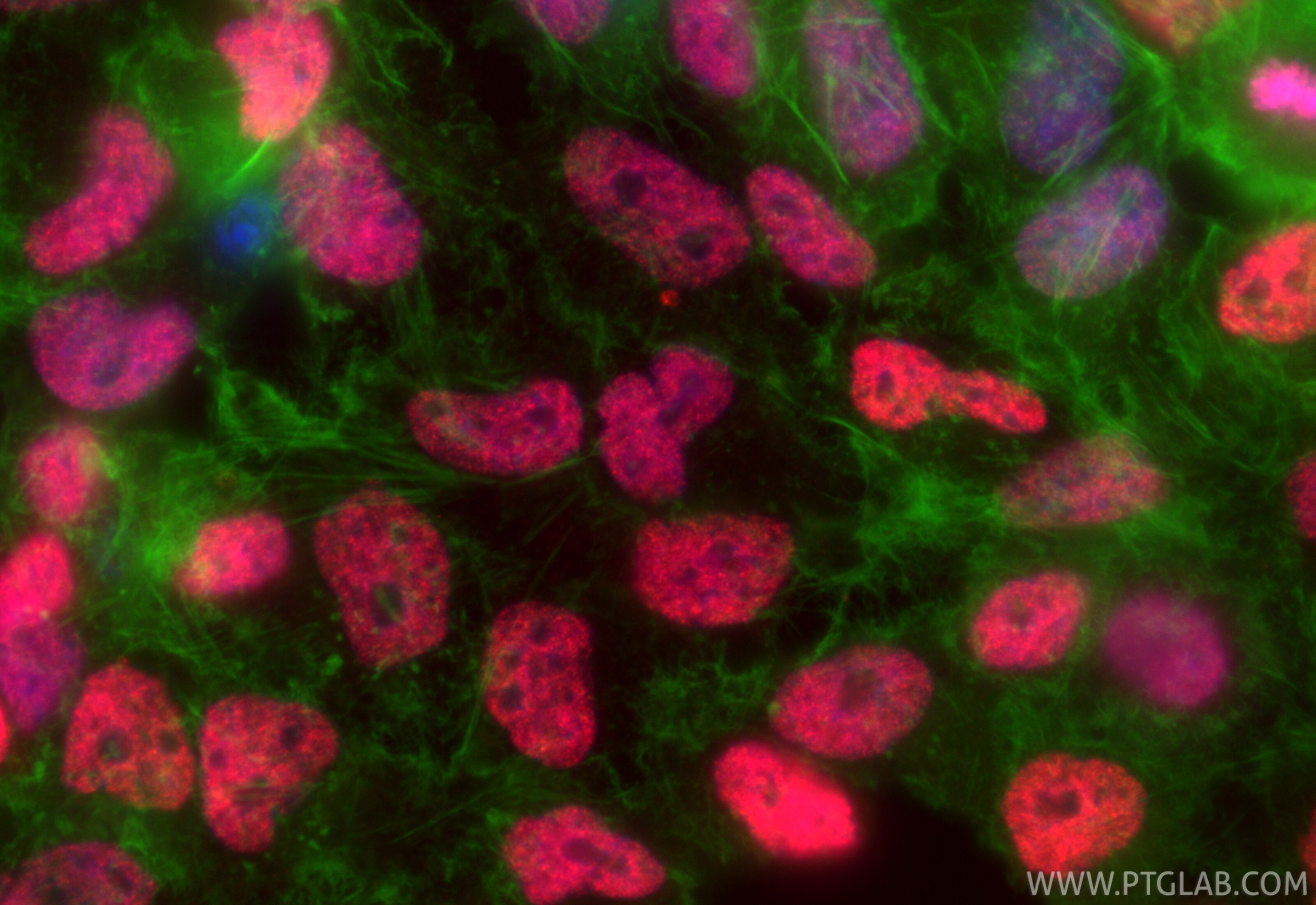 Immunofluorescent analysis of (4% PFA) fixed HeLa cells using CoraLite®594 Acetyl-Histone H2B (Lys20) antibody (CL594-84549, Clone: 241204H8 ) at dilution of 1:200, CL488-Phalloidin (green). Immunofluorescence (IF) / fluorescent staining of HeLa cells using CoraLite®594-conjugated Acetyl-Histone H2B (Lys20) (CL594-84549)