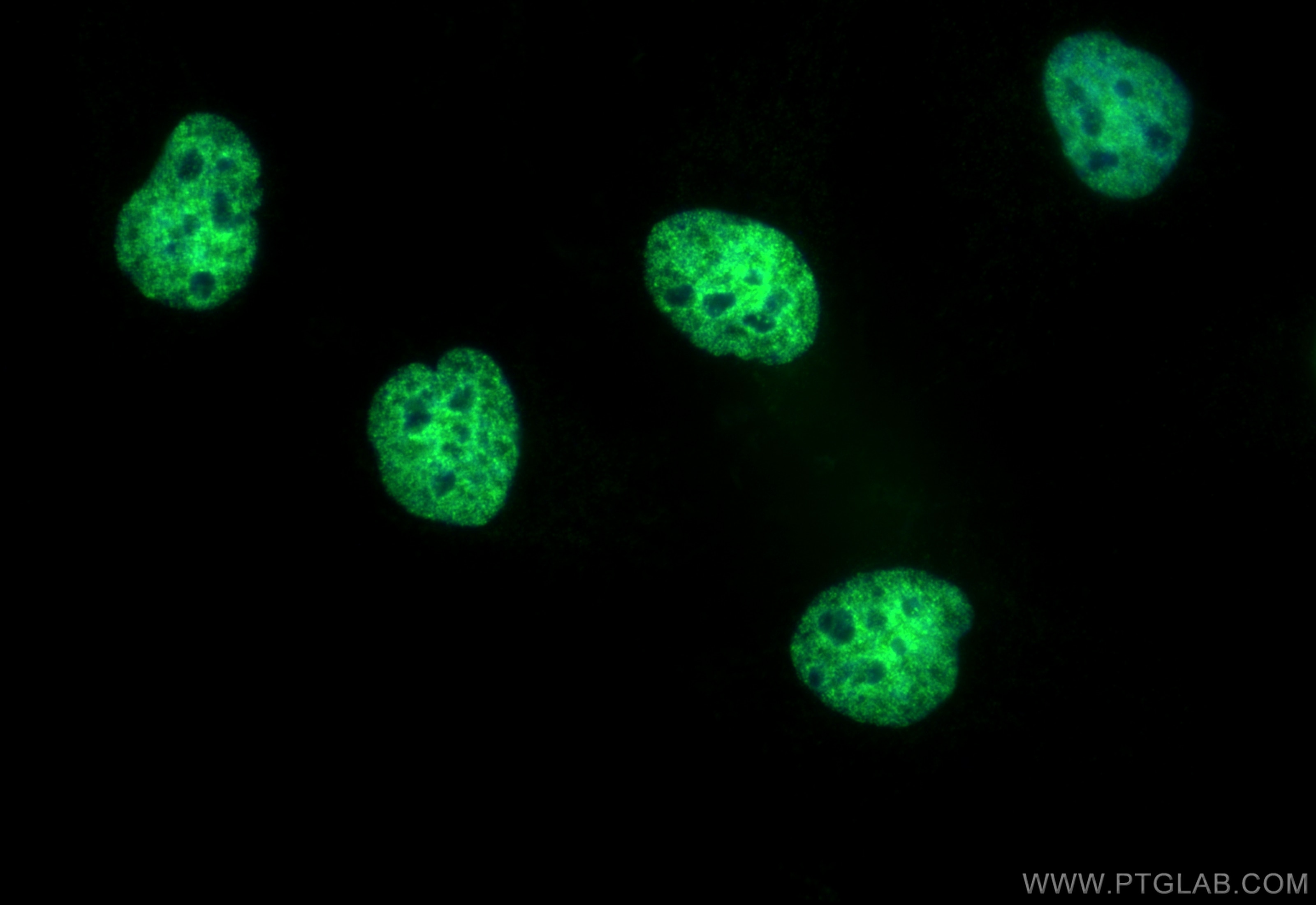Immunofluorescence (IF) / fluorescent staining of HeLa cells using CoraLite® Plus 488-conjugated Acetyl-Histone H3 (L (CL488-82838-2)