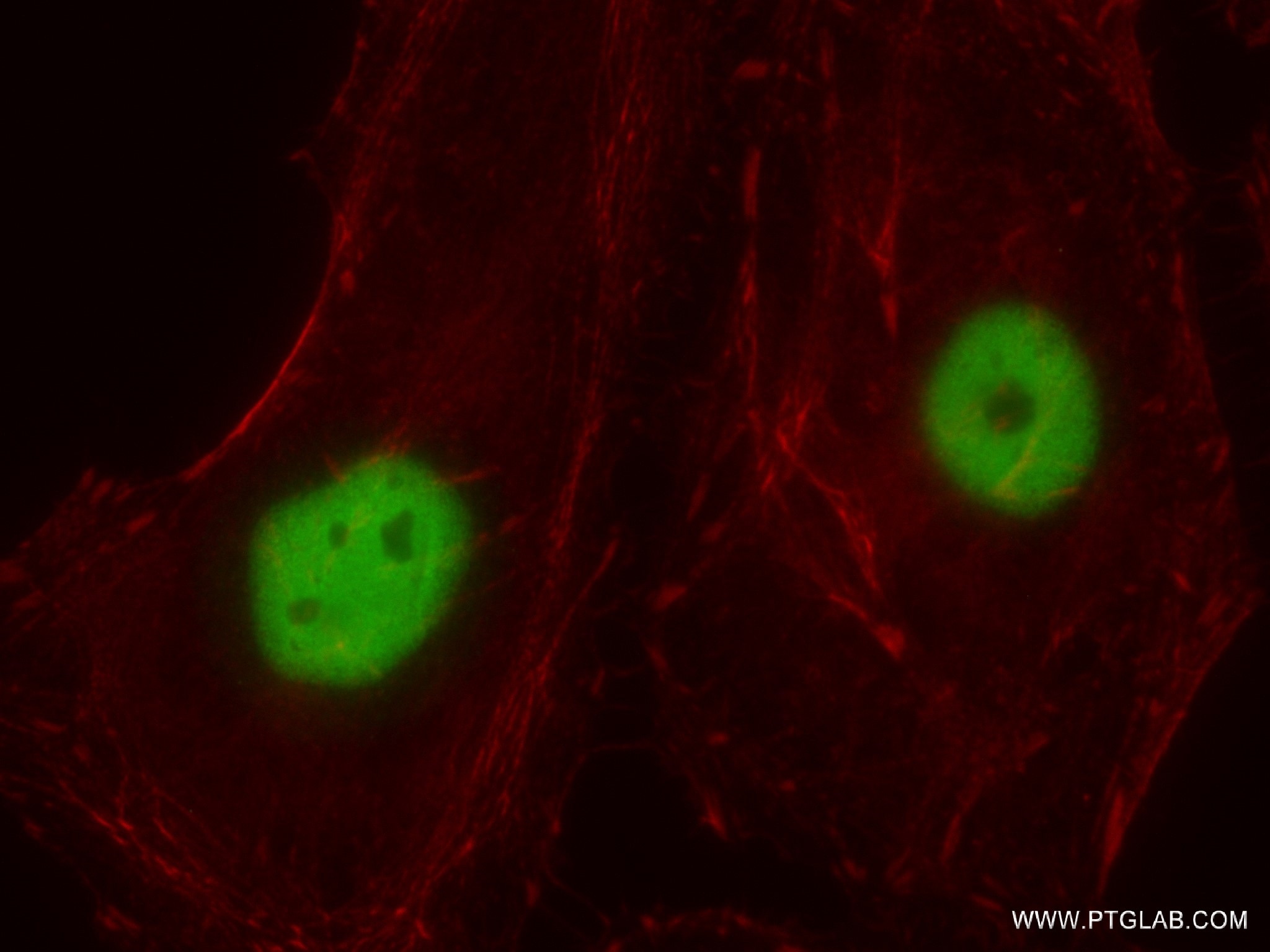 Immunofluorescence (IF) / fluorescent staining of HeLa cells using Acetyl-Histone H3 (Lys27) Recombinant antibody (82902-1-RR)