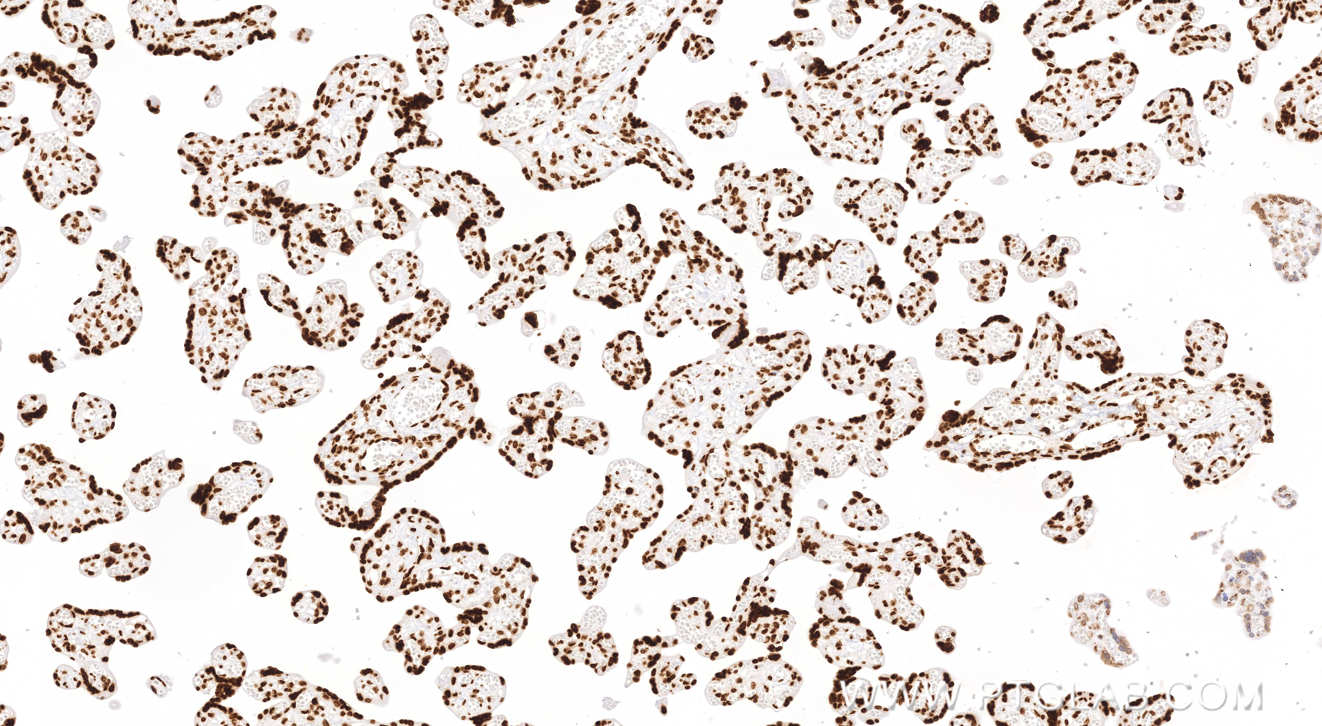 Immunohistochemistry (IHC) staining of human placenta tissue using Acetyl-Histone H3 (Lys27) Recombinant monoclonal a (82902-1-RR)
