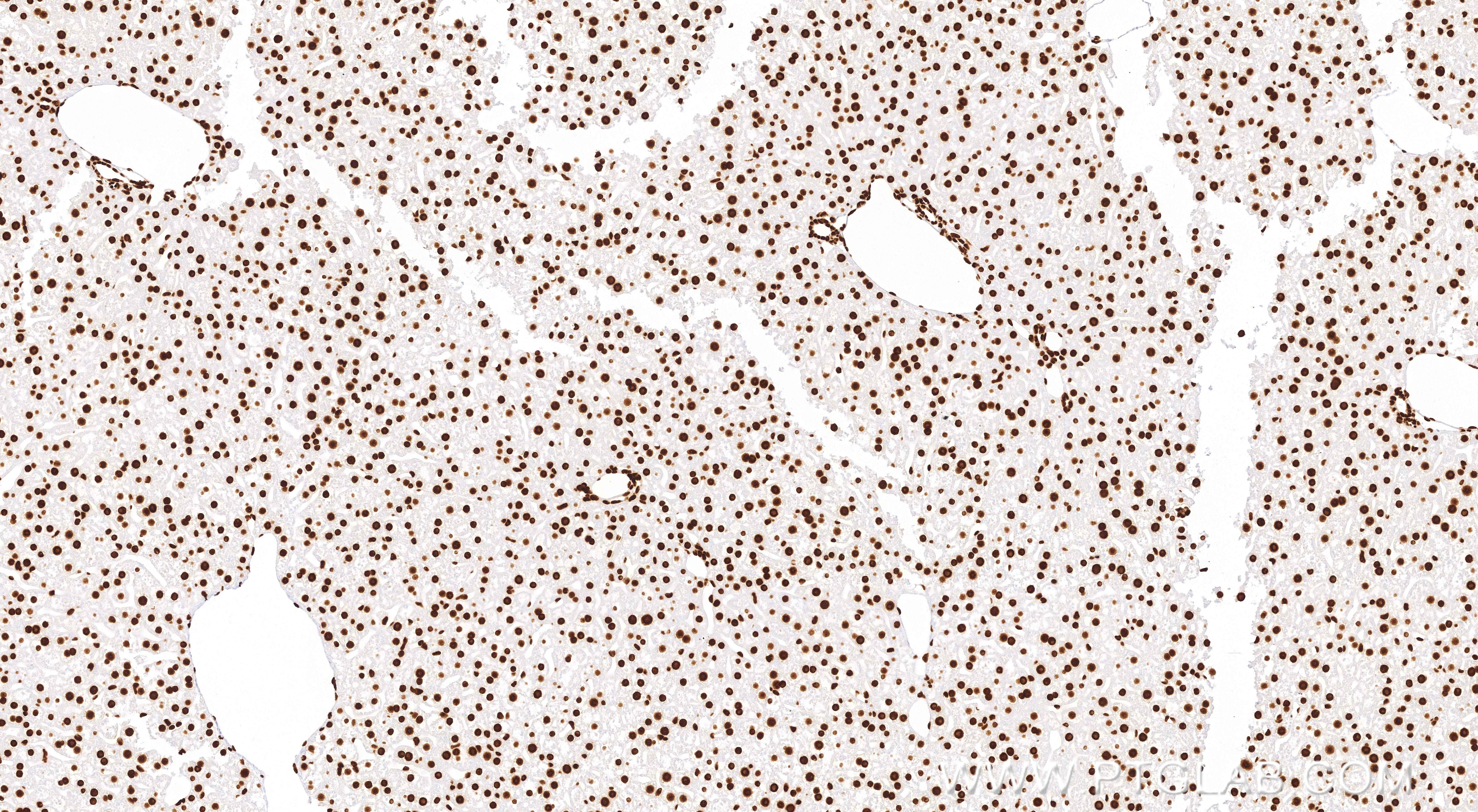 Immunohistochemistry (IHC) staining of mouse liver tissue using Acetyl-Histone H3 (Lys27) Recombinant monoclonal a (82902-1-RR)