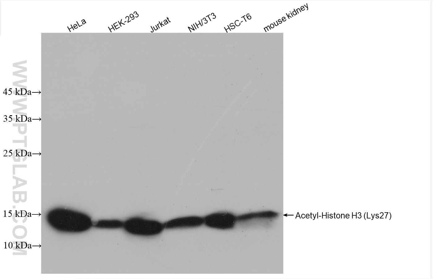 Western Blot (WB) analysis of HeLa cells using Acetyl-Histone H3 (Lys27) Recombinant antibody (82902-1-RR)