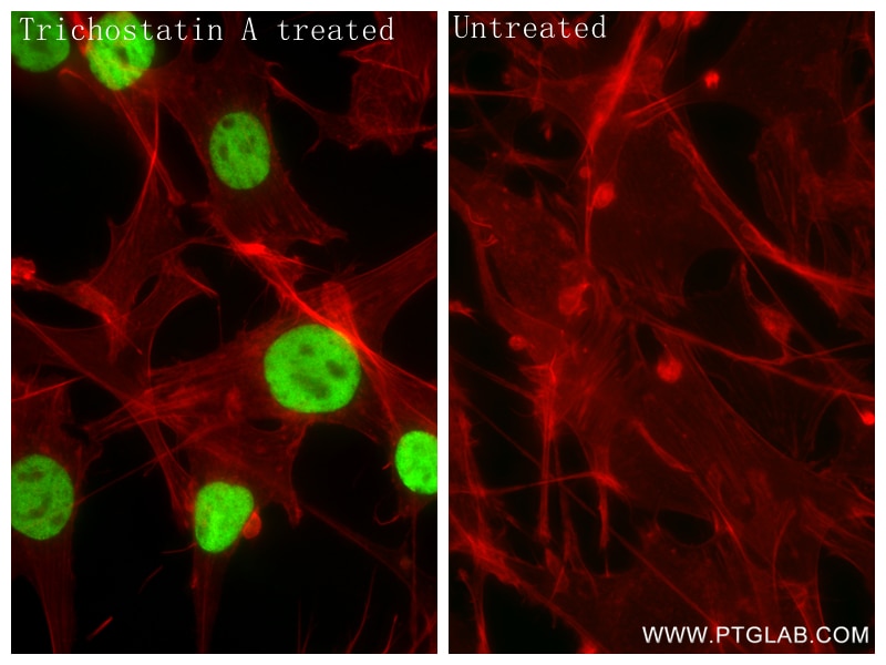 Immunofluorescence (IF) / fluorescent staining of NIH/3T3 cells using Acetyl-Histone H3 (Lys36) Recombinant monoclonal a (82828-14-RR)