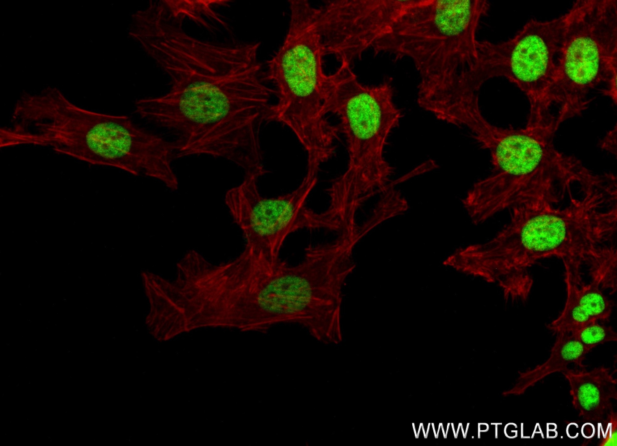 Immunofluorescence (IF) / fluorescent staining of HeLa cells using  Acetyl-Histone H3 (Lys4) Recombinant antibody (84831-1-RR)