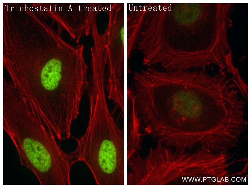 Immunofluorescence (IF) / fluorescent staining of HeLa cells using Acetyl-Histone H3 (Lys4) Recombinant antibody (84831-1-RR)