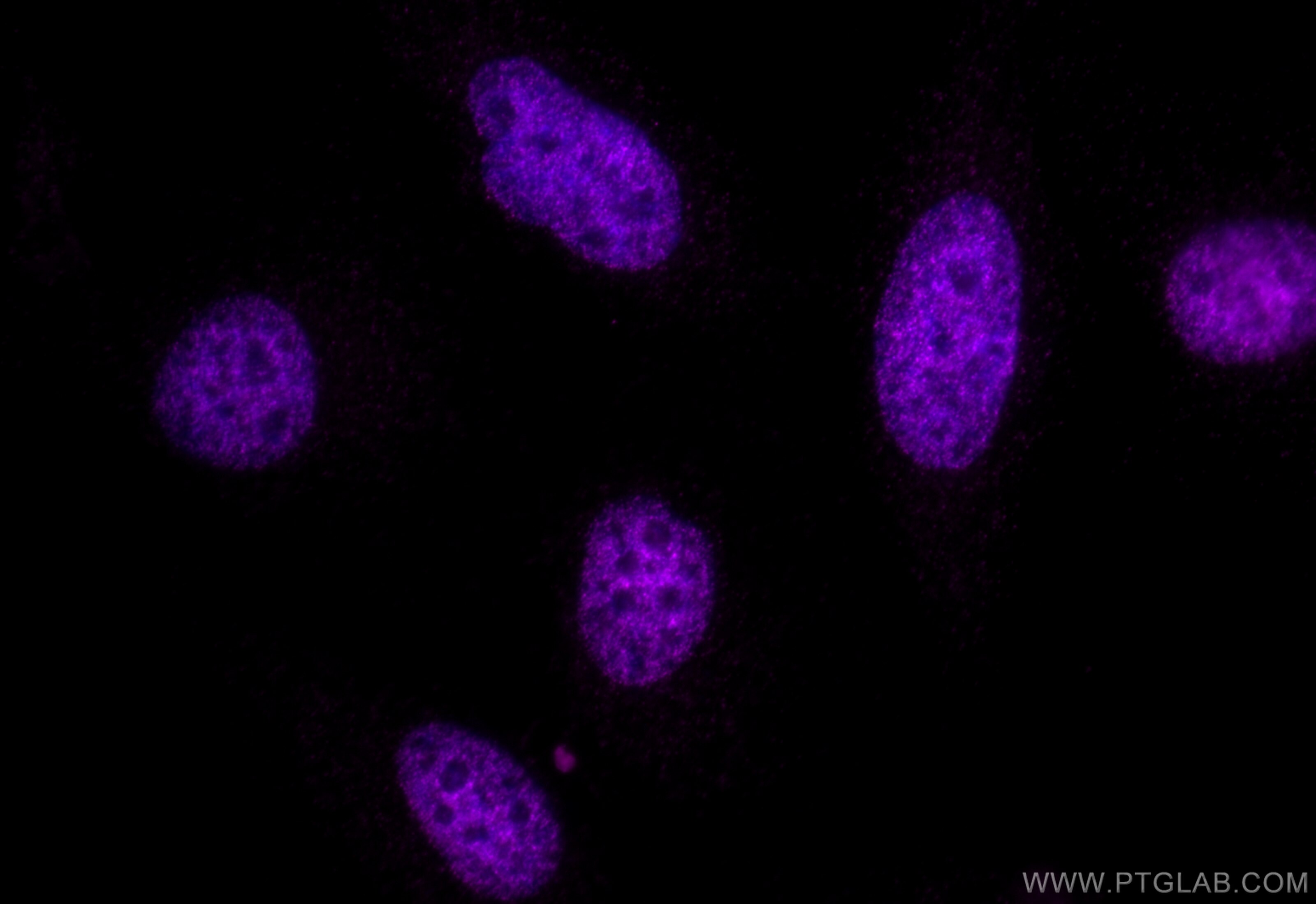 Immunofluorescence (IF) / fluorescent staining of HeLa cells using CoraLite® Plus 647-conjugated Acetyl-Histone H3 (L (CL647-84831)