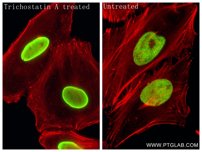 IF Staining of HeLa using 86860-1-RR Immunofluorescence (IF) / fluorescent staining of HeLa cells using Acetyl-Histone H3 (Lys9/Lys27) Recombinant monoclo (86860-1-RR)