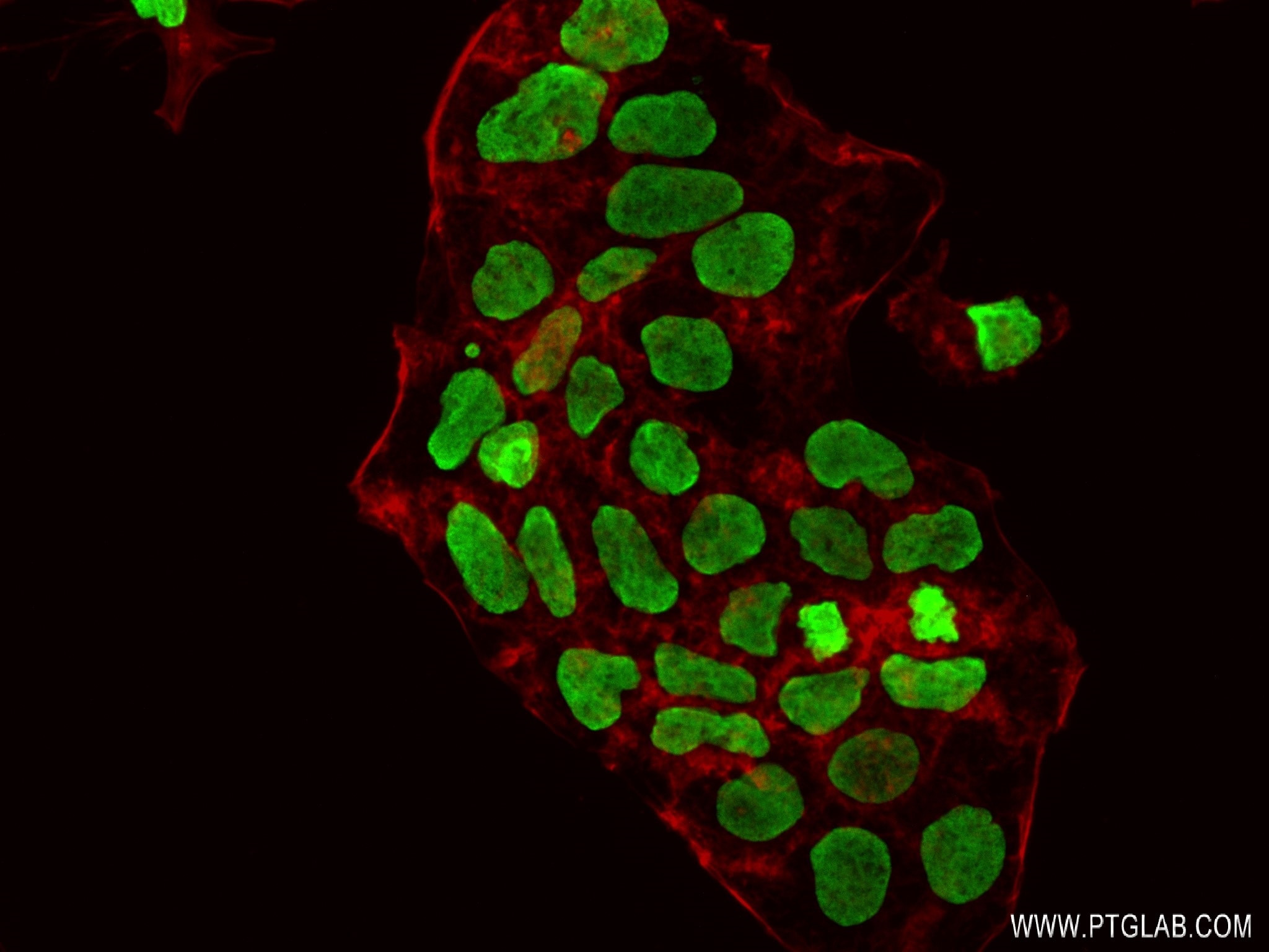 IF Staining of Caco-2 using 83095-1-RR
