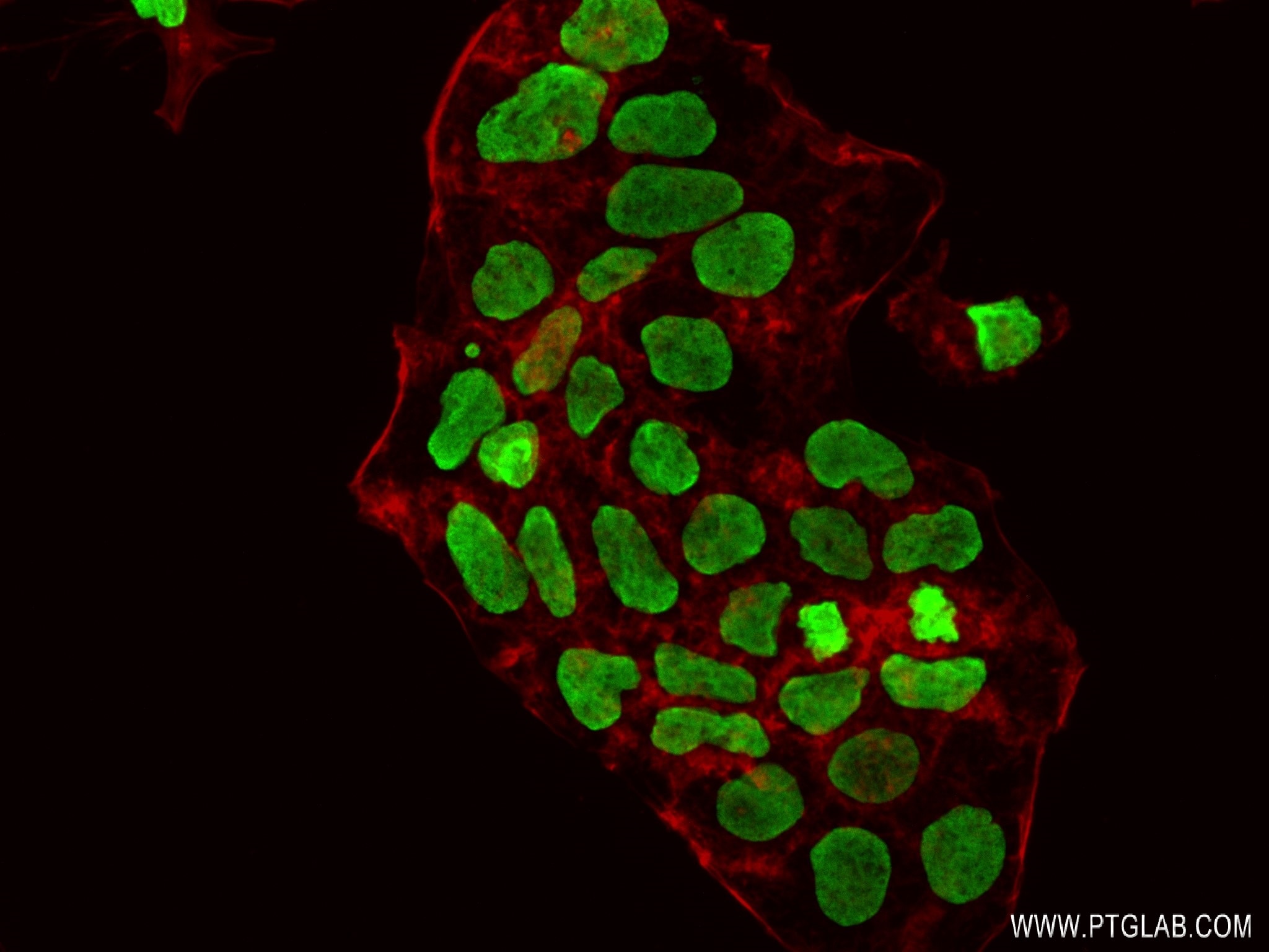 Immunofluorescence (IF) / fluorescent staining of Caco-2 cells using Acetyl-Histone H4 (Lys12) Recombinant antibody (83095-1-RR)