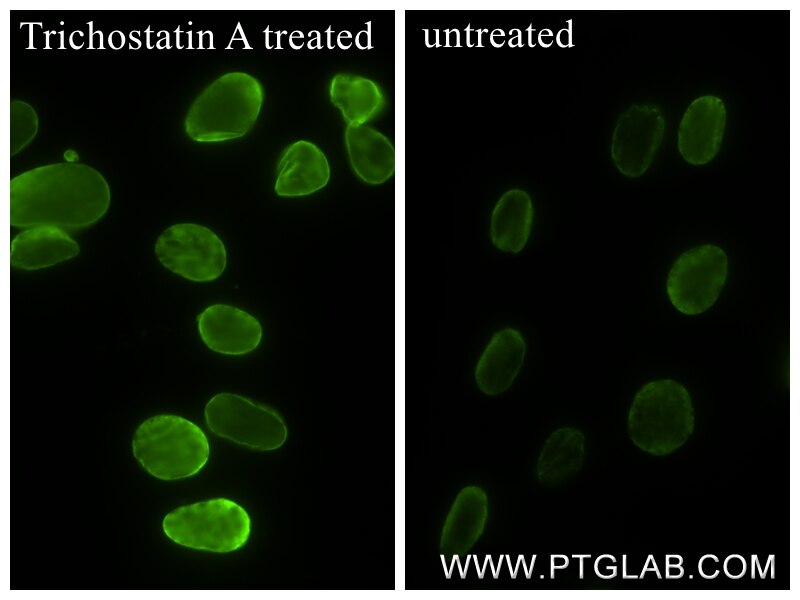 Immunofluorescent analysis of (4% PFA) fixed Trichostatin A treated NIH/3T3 cells using Acetyl-Histone H4 (Lys12) antibody (83095-1-RR, Clone: 1D18 ) at dilution of 1:4000 and CoraLite®488-Conjugated Goat Anti-Rabbit IgG(H+L) (SA00013-2). Immunofluorescence (IF) / fluorescent staining of NIH/3T3 cells using Acetyl-Histone H4 (Lys12) Recombinant monoclonal a (83095-1-RR)