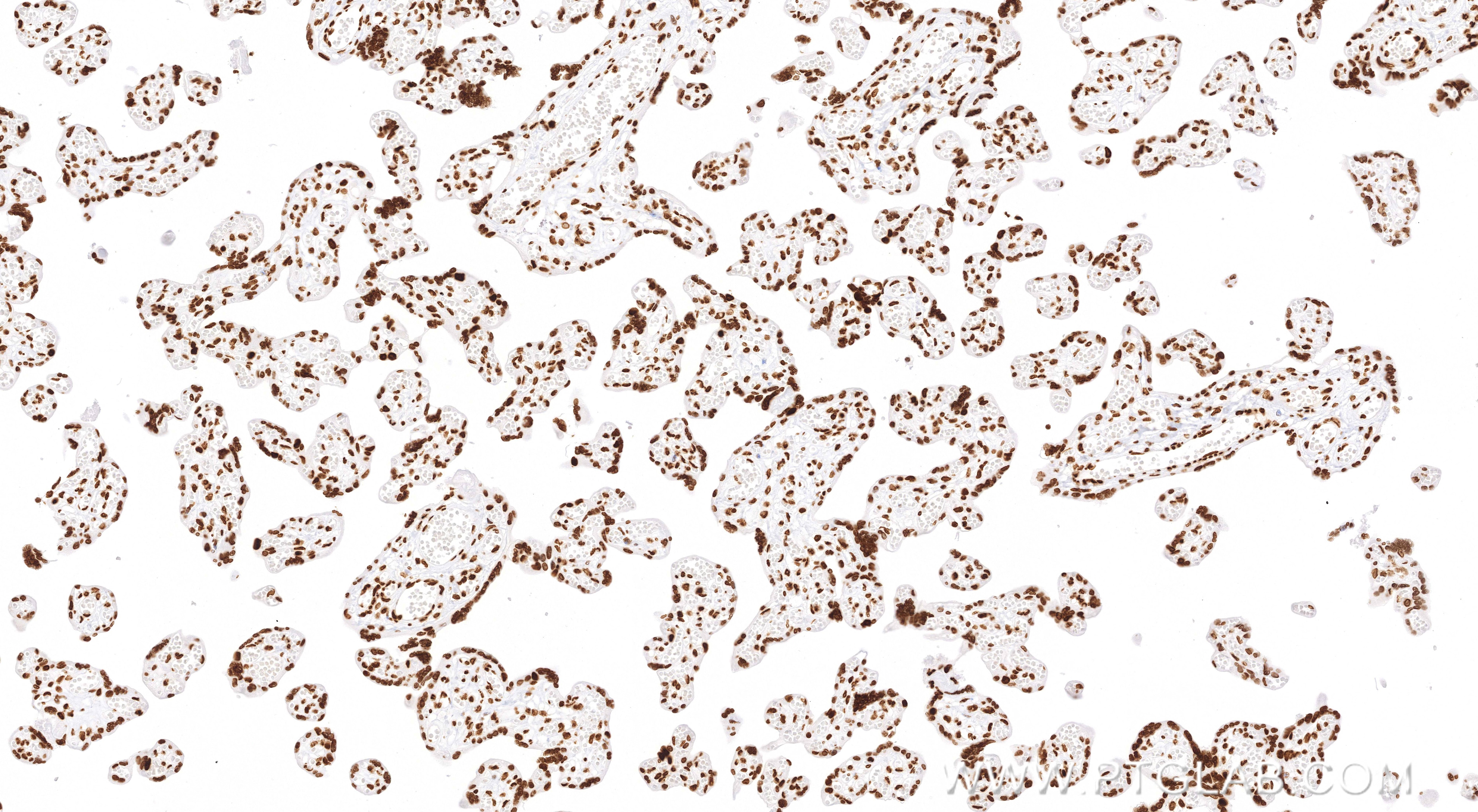 Immunohistochemistry (IHC) staining of human placenta tissue using Acetyl-Histone H4 (Lys12) Recombinant monoclonal a (83095-1-RR)
