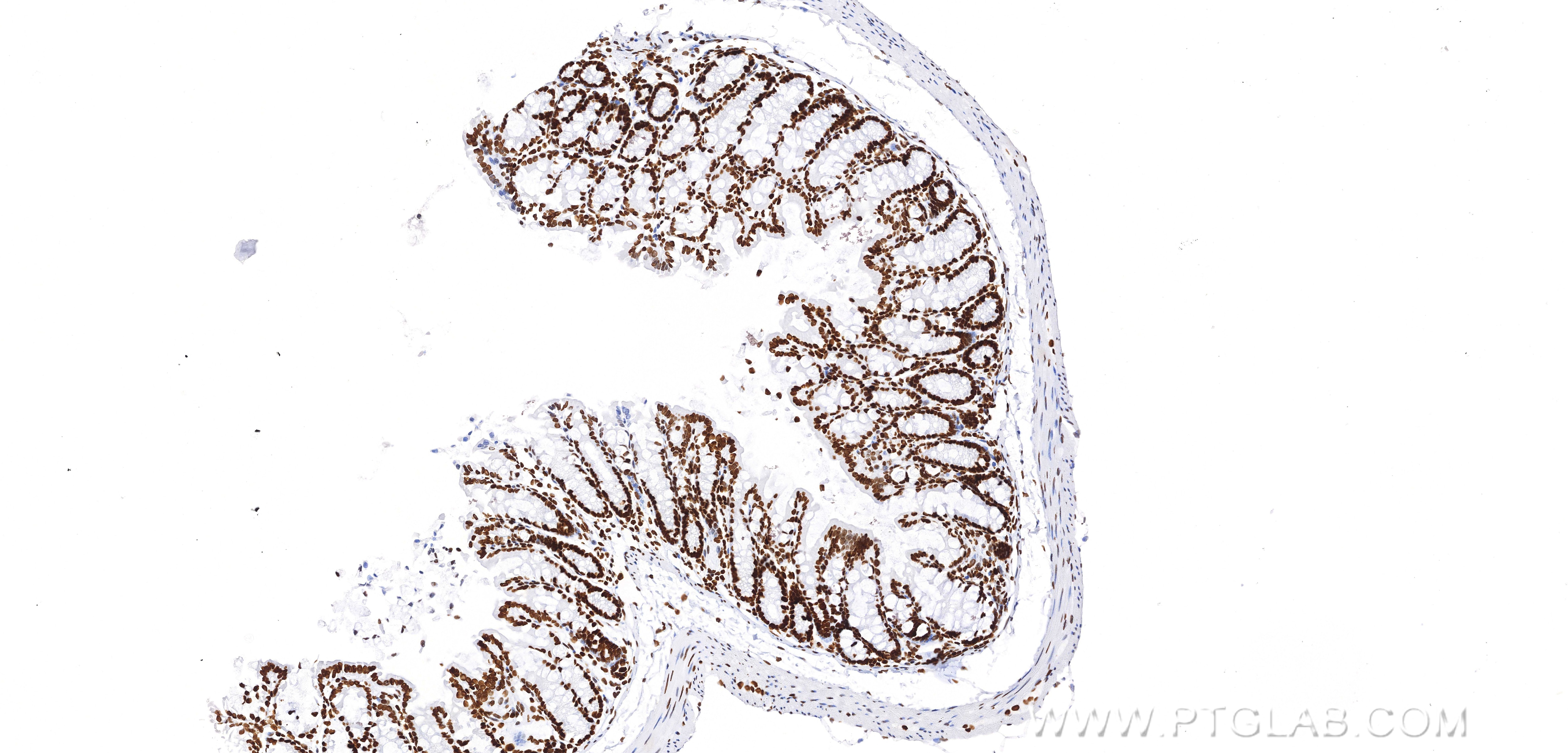 Immunohistochemistry (IHC) staining of mouse colon tissue using Acetyl-Histone H4 (Lys12) Recombinant monoclonal a (83095-1-RR)