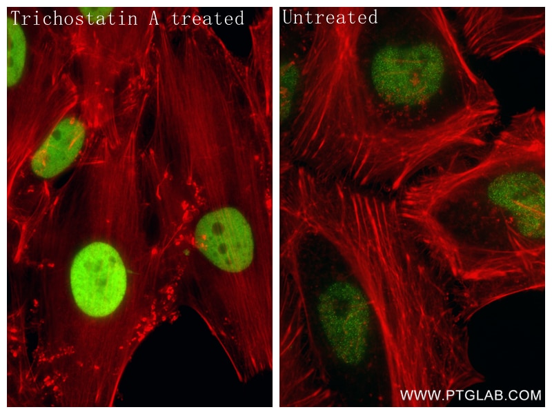 IF Staining of HeLa using 86768-1-RR (same clone as 86768-1-PBS) Immunofluorescence (IF) / fluorescent staining of HeLa cells using Acetyl-Histone H4 (Lys91) Recombinant monoclonal a (86768-1-RR)