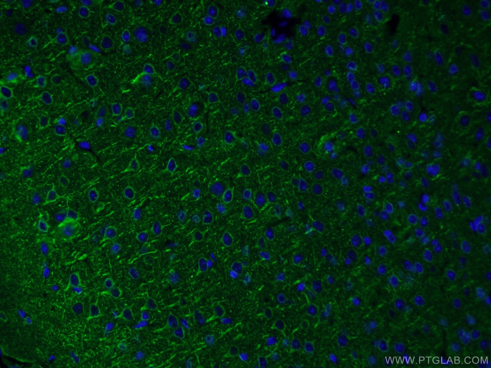 Immunofluorescence (IF) / fluorescent staining of mouse brain tissue using acetylated Tubulin(Lys40) Monoclonal antibody (66200-1-Ig)