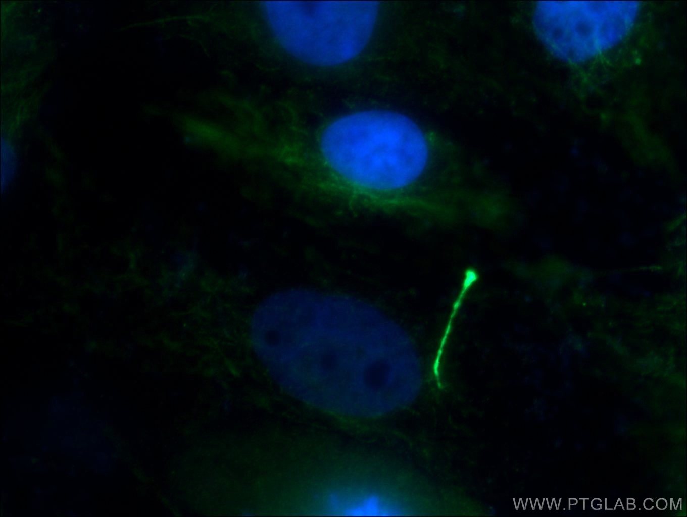 Acetyl-Tubulin (Lys40) Monoclonal antibody