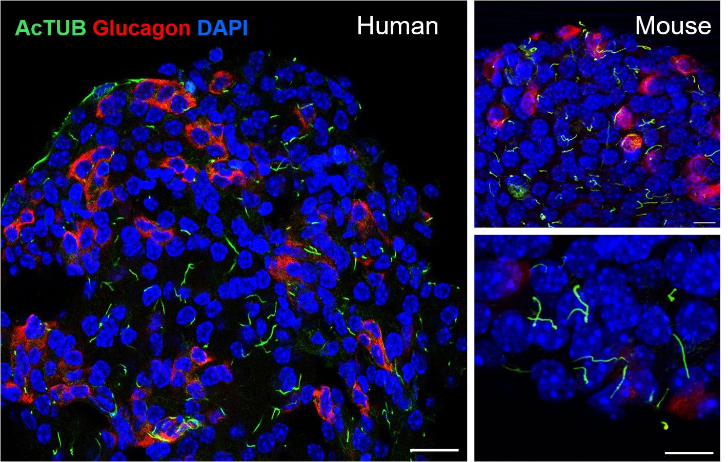 IF Staining of islet using 66200-1-Ig