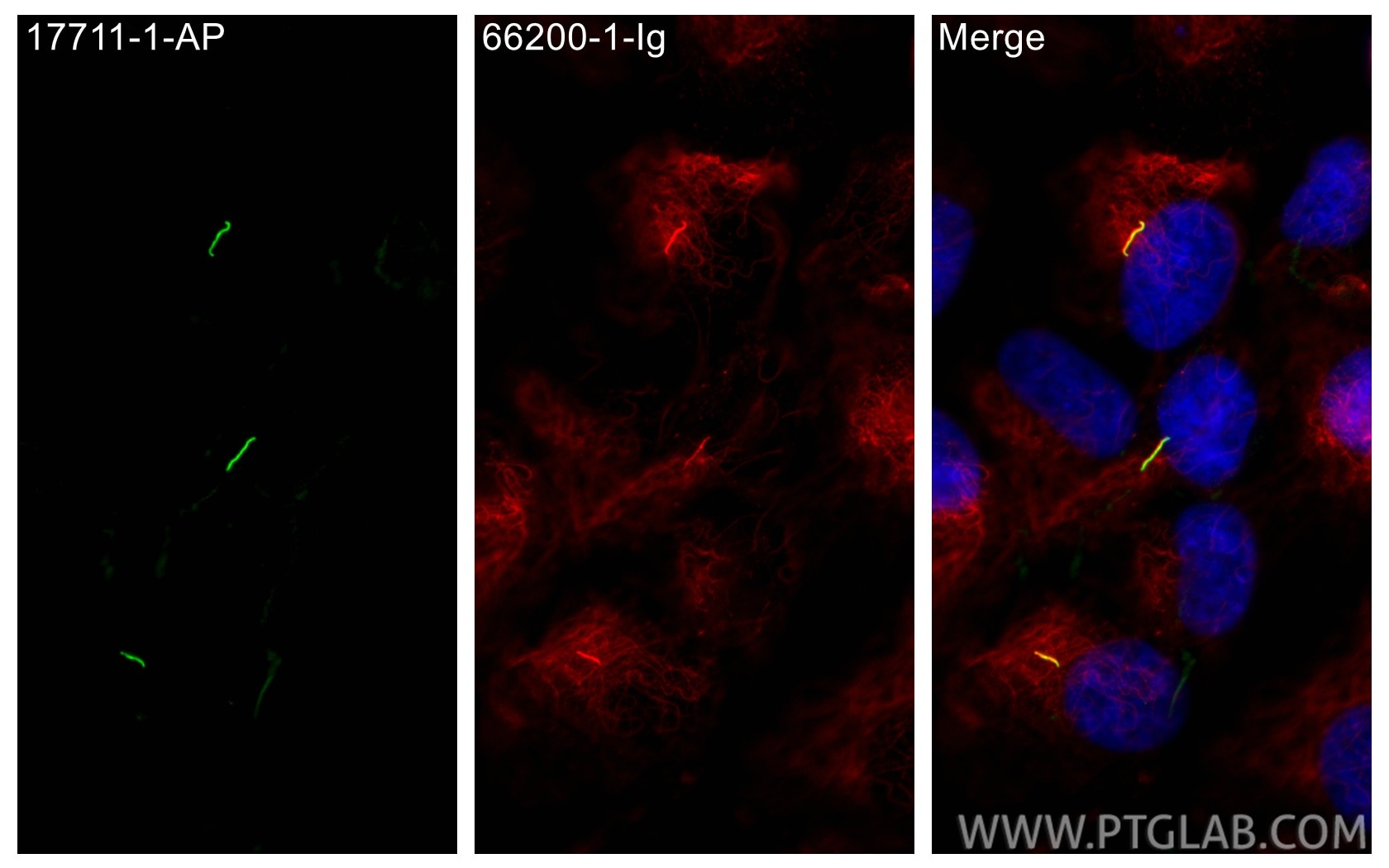 Immunofluorescence (IF) / fluorescent staining of hTERT-RPE1 cells using Acetyl-Tubulin (Lys40) Monoclonal antibody (66200-1-Ig)