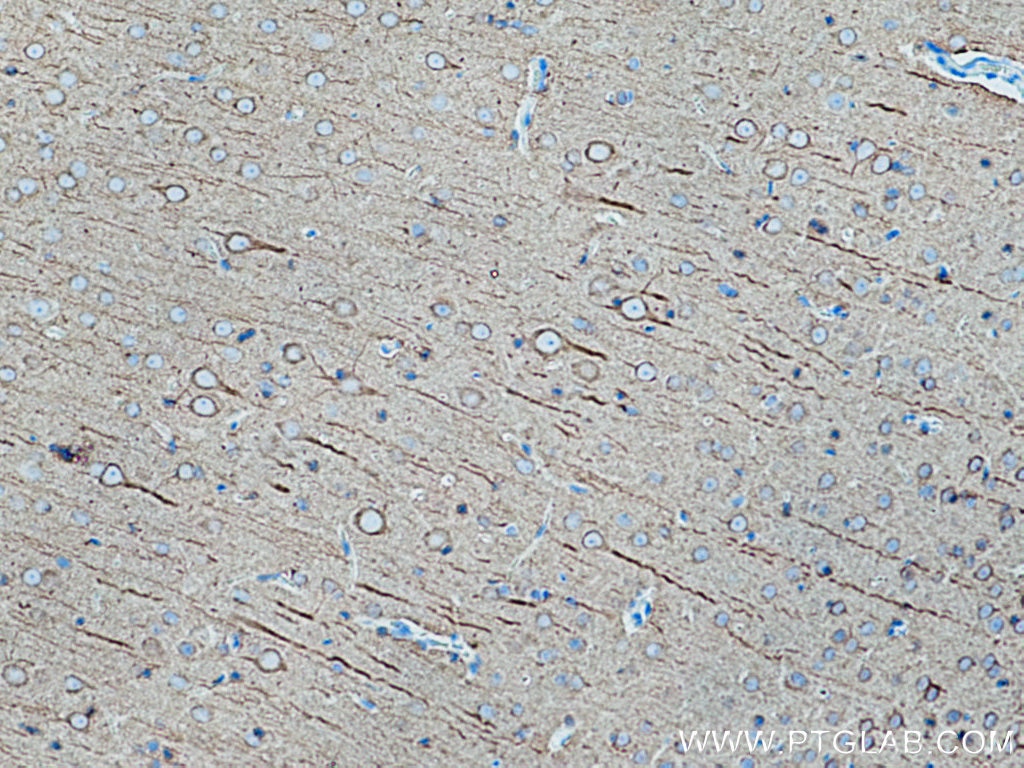 Immunohistochemistry (IHC) staining of rat brain tissue using acetylated Tubulin(Lys40) Monoclonal antibody (66200-1-Ig)