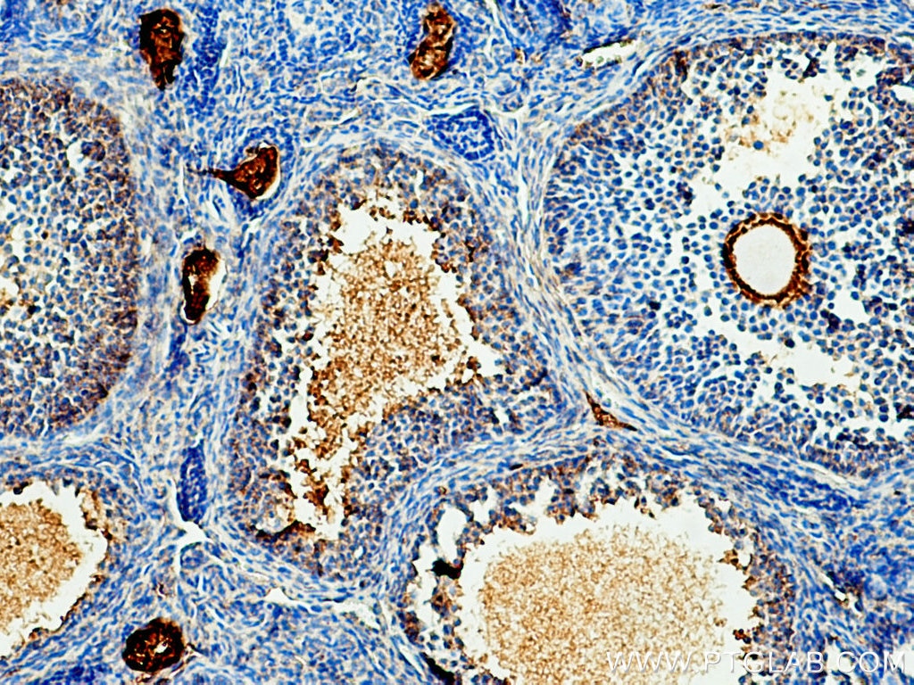 Immunohistochemistry (IHC) staining of mouse ovary tissue using acetylated Tubulin(Lys40) Monoclonal antibody (66200-1-Ig)