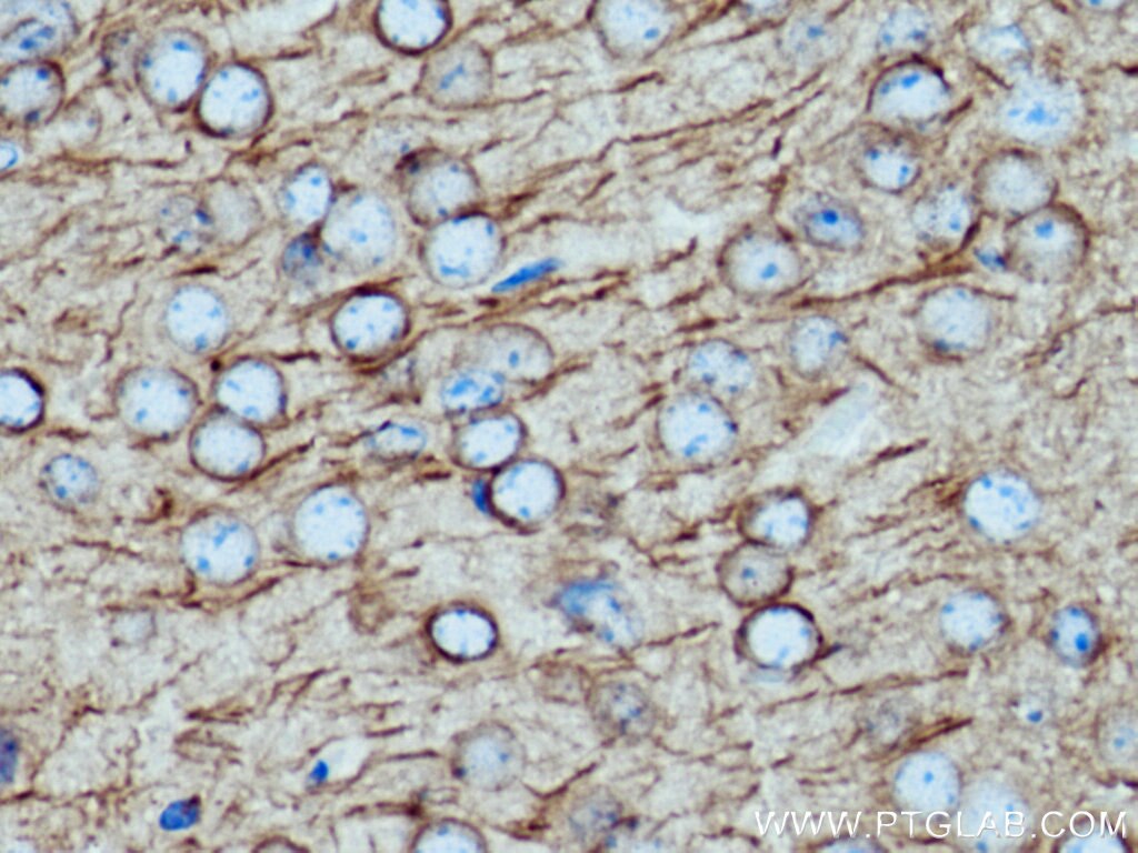 Immunohistochemistry (IHC) staining of mouse brain tissue using acetylated Tubulin(Lys40) Monoclonal antibody (66200-1-Ig)