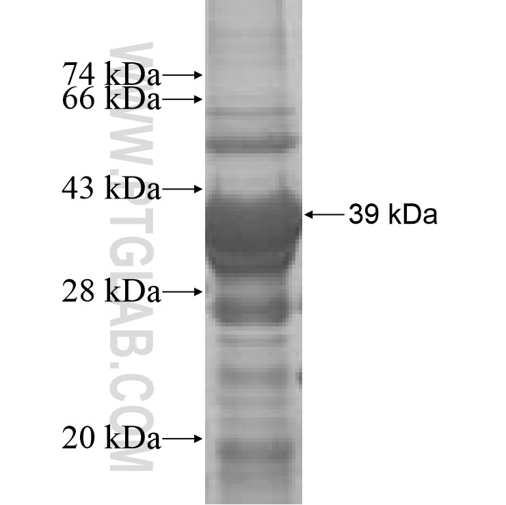 Acsl3 fusion protein Ag7433 SDS-PAGE