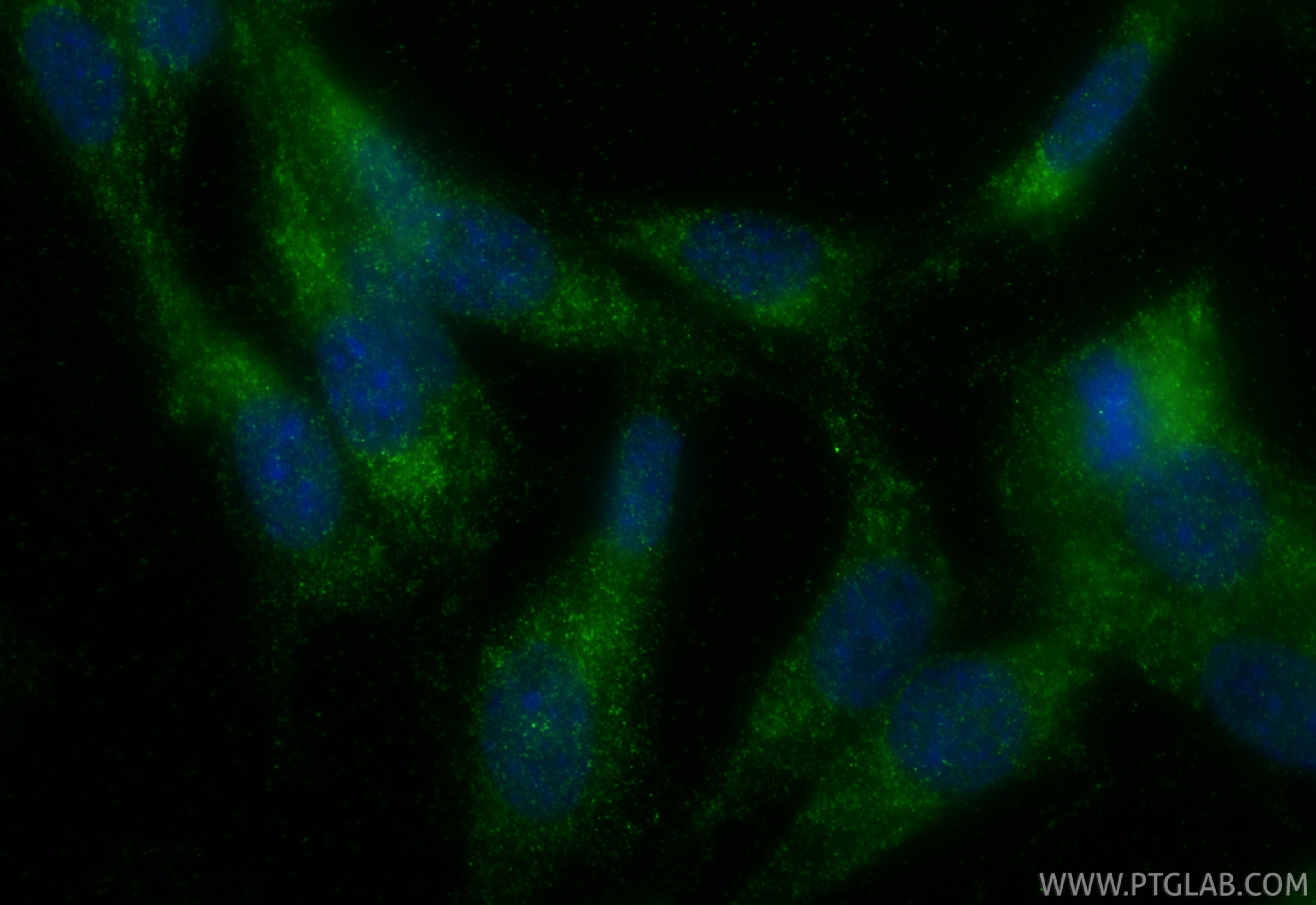 Immunofluorescent analysis of (4% PFA) fixed NIH/3T3 cells using Adiponectin antibody (30723-1-AP) at dilution of 1:400 and CoraLite®488-Conjugated Goat Anti-Rabbit IgG(H+L) (SA00013-2). Immunofluorescence (IF) / fluorescent staining of NIH/3T3 cells using Adiponectin Polyclonal antibody (30723-1-AP)