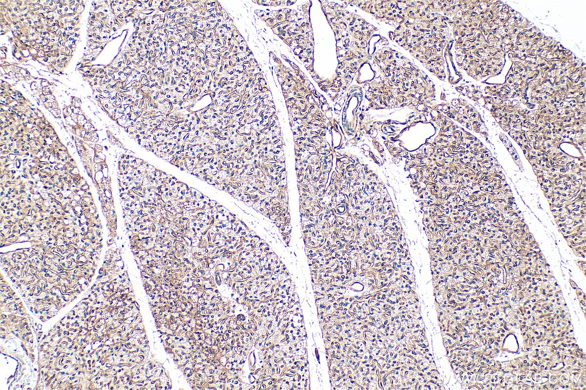 Immunohistochemistry (IHC) staining of mouse brown adipose tissue using Adiponectin Polyclonal antibody (30723-1-AP)