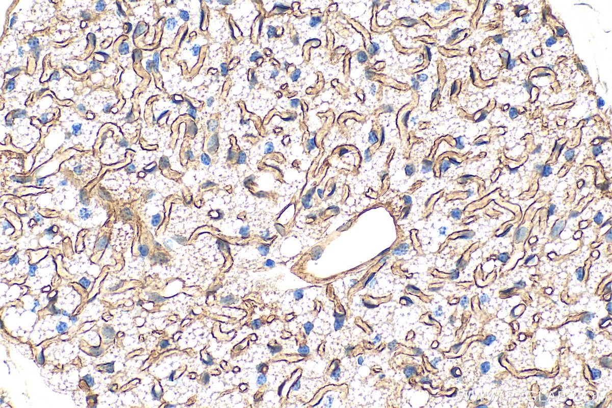 Immunohistochemistry (IHC) staining of mouse brown adipose tissue using Adiponectin Polyclonal antibody (30723-1-AP)