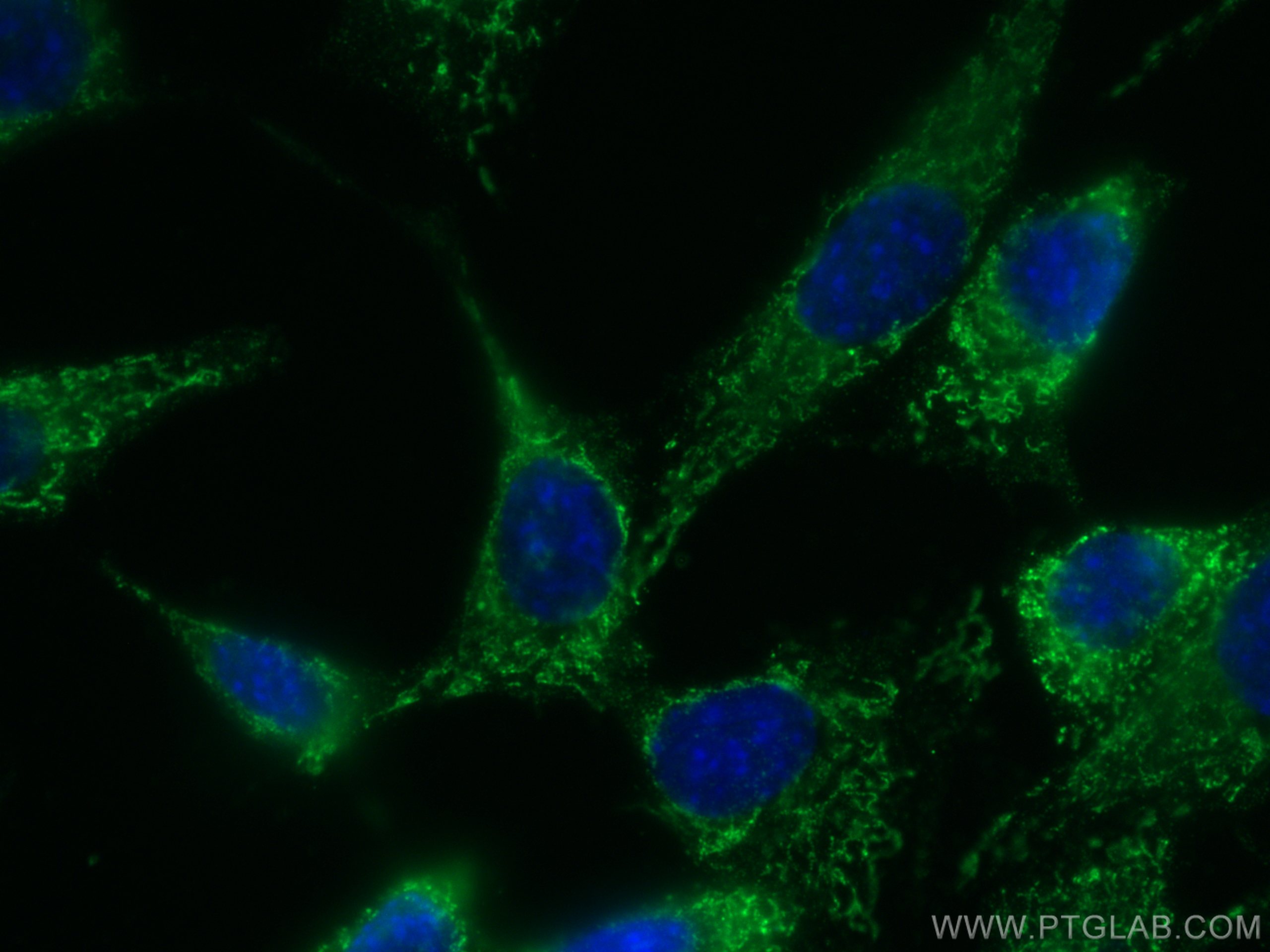 Immunofluorescence (IF) / fluorescent staining of 3T3-L1 cells using CoraLite®488-conjugated Adiponectin Monoclonal ant (CL488-66239)