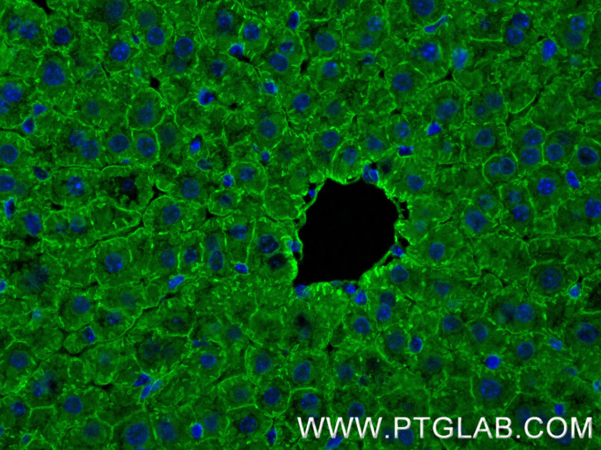Immunofluorescence (IF) / fluorescent staining of mouse liver tissue using Adiponectin receptor Recombinant antibody (85121-4-RR)