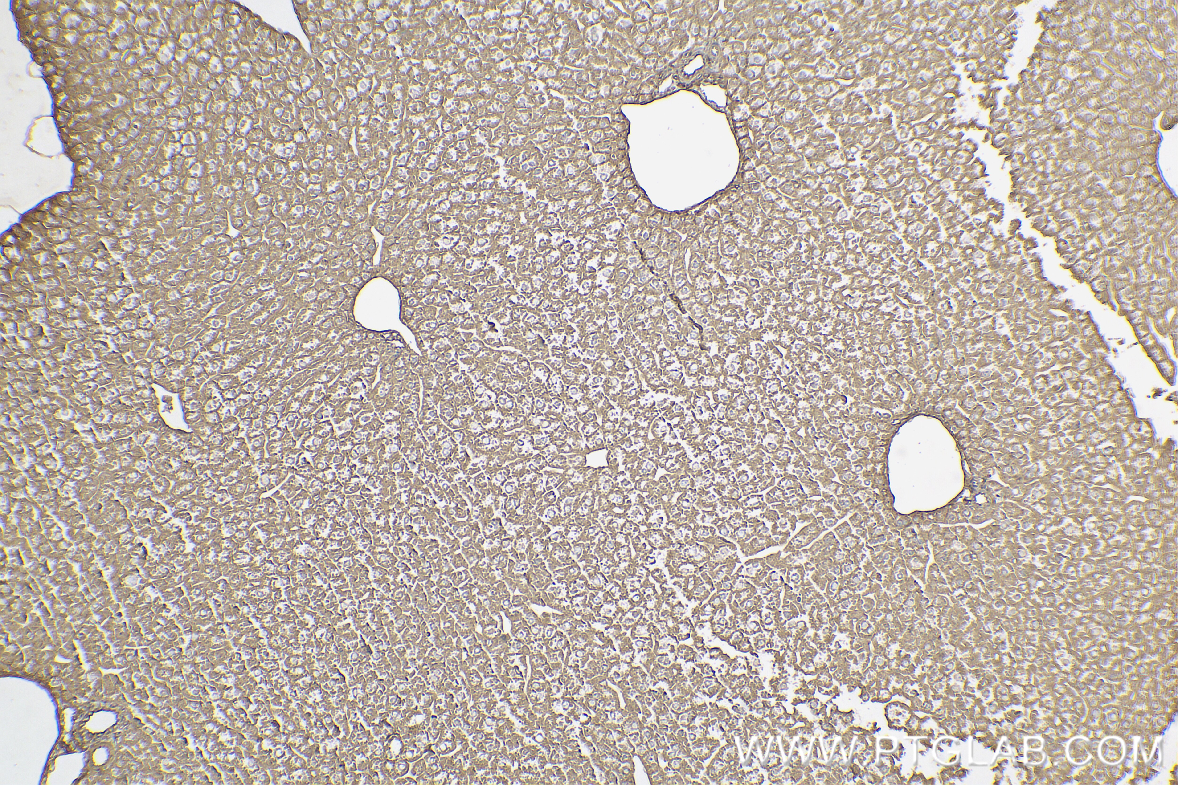 Immunohistochemistry (IHC) staining of mouse liver tissue using Adiponectin receptor Recombinant antibody (85121-4-RR)
