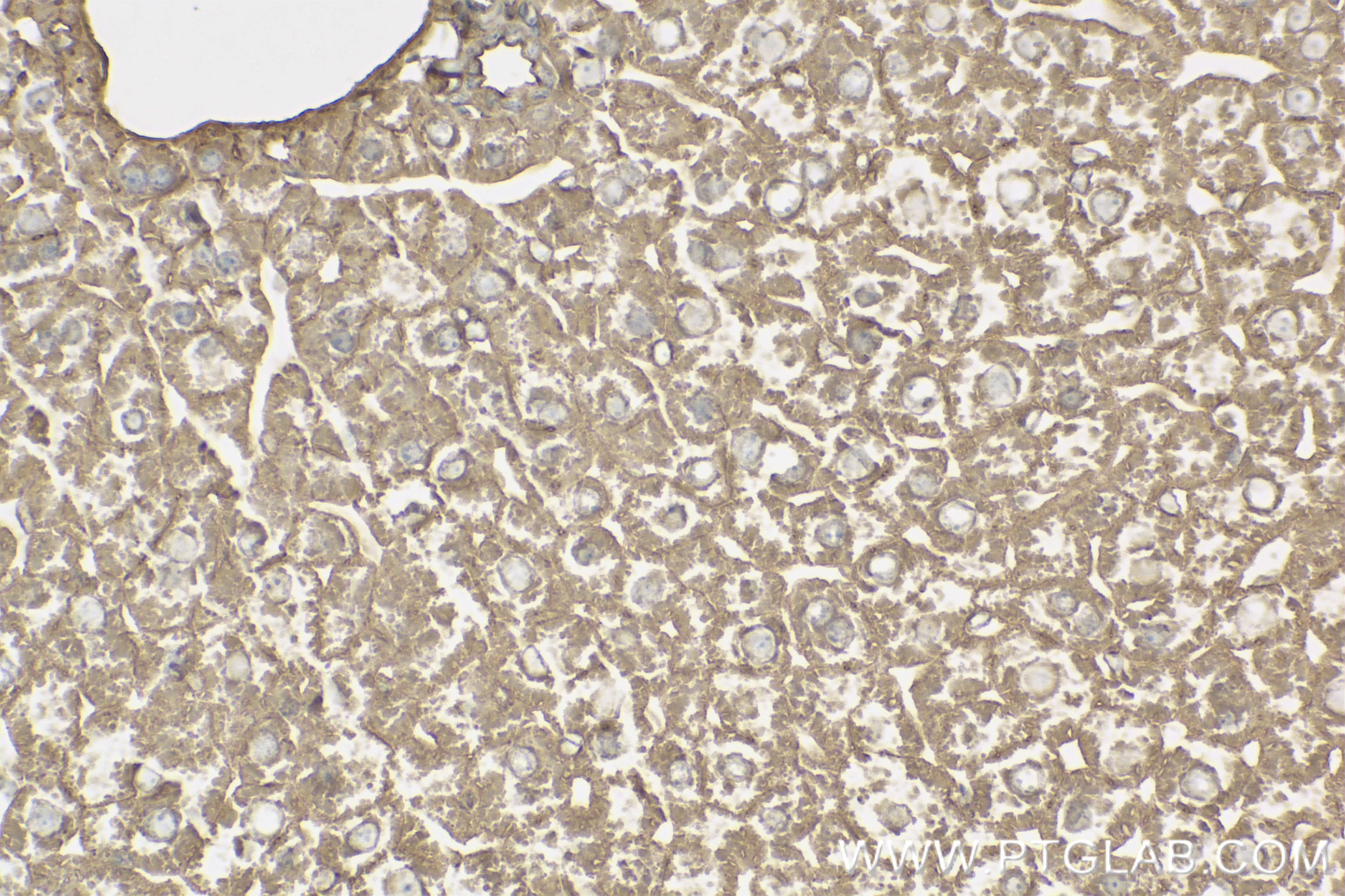 Immunohistochemistry (IHC) staining of mouse liver tissue using Adiponectin receptor Recombinant antibody (85121-4-RR)
