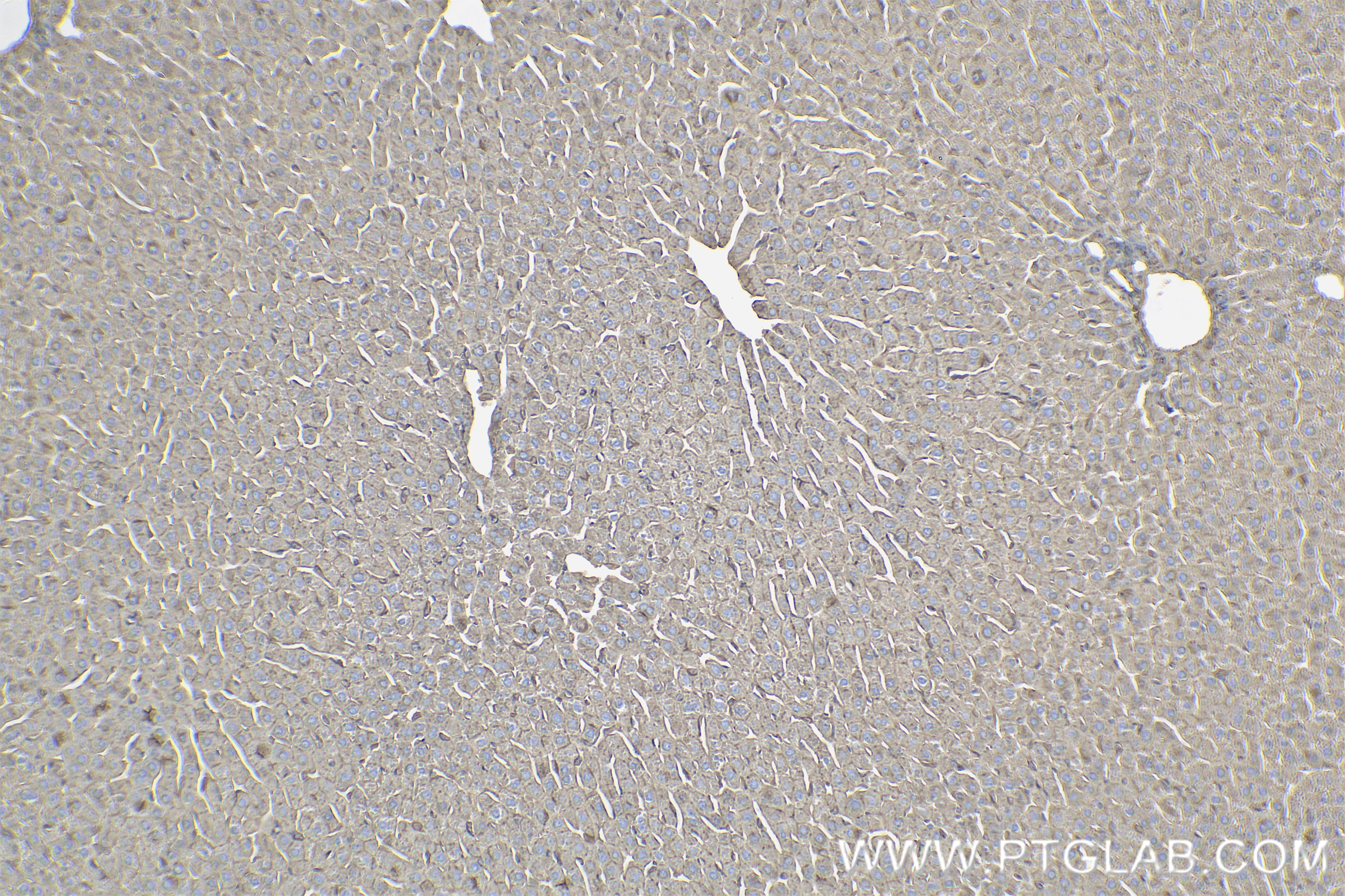 Immunohistochemistry (IHC) staining of rat liver tissue using Adiponectin receptor Recombinant antibody (85121-4-RR)