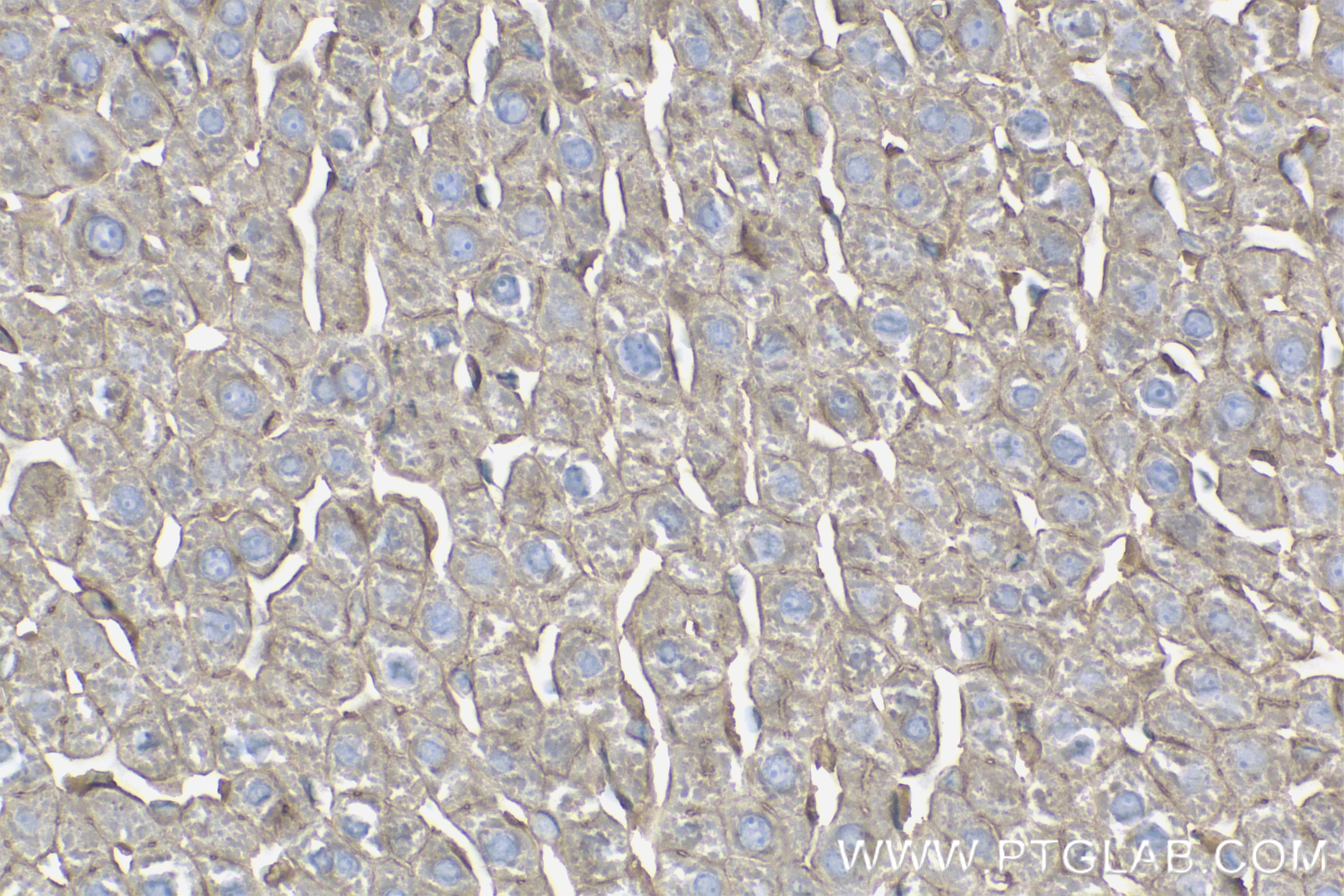 Immunohistochemistry (IHC) staining of rat liver tissue using Adiponectin receptor Recombinant antibody (85121-4-RR)