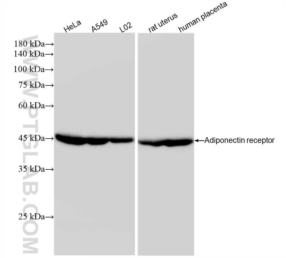 Western Blot (WB) analysis of various lysates using Adiponectin receptor Recombinant antibody (85121-4-RR)