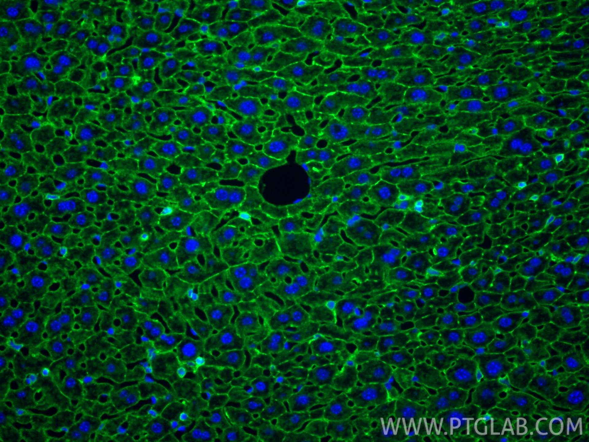 Immunofluorescence (IF) / fluorescent staining of mouse liver tissue using CoraLite® Plus 488-conjugated Adiponectin receptor (CL488-85121-4)