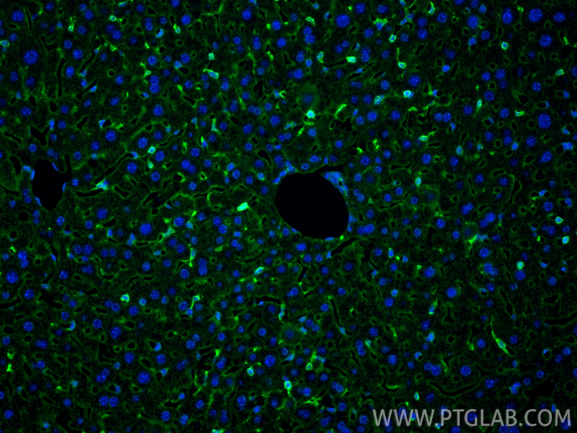 IF Staining of mouse liver using RMX00098 Immunofluorescence (IF) / fluorescent staining of mouse liver tissue using Multi-rAb® Adiponectin receptor Multi-Recombinant (RMX00098)