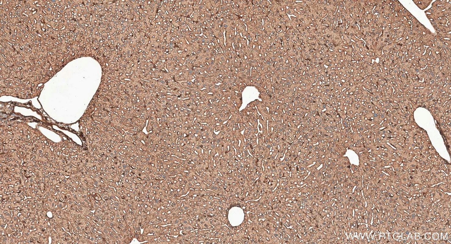 IHC staining of mouse liver using RMX00098 Immunohistochemistry (IHC) staining of mouse liver tissue using Multi-rAb® Adiponectin receptor Multi-Recombinant (RMX00098)