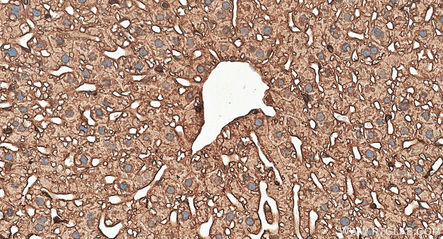 IHC staining of mouse liver using RMX00098 Immunohistochemistry (IHC) staining of mouse liver tissue using Multi-rAb® Adiponectin receptor Multi-Recombinant (RMX00098)