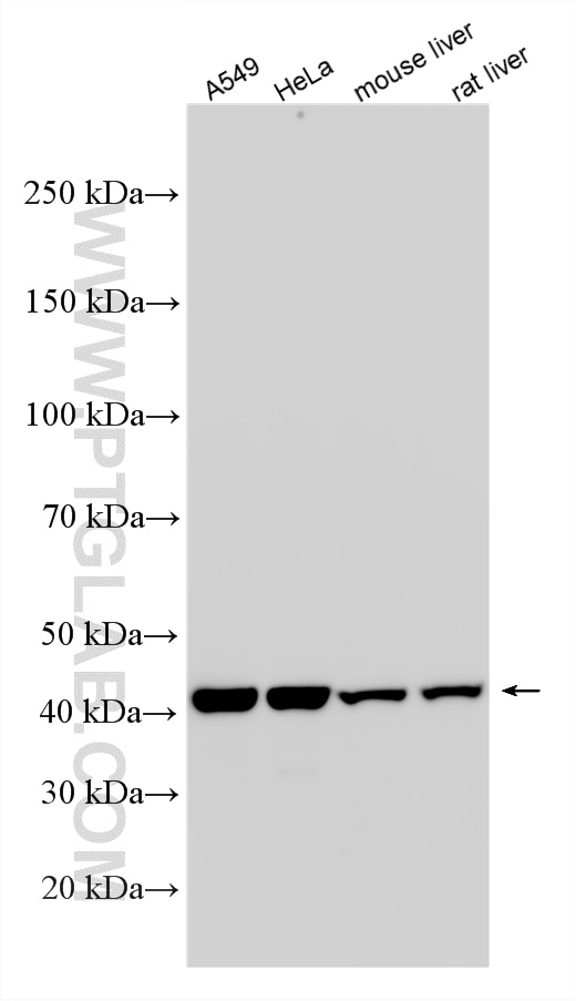 WB analysis using RMX00098 Western Blot (WB) analysis of various lysates using Multi-rAb® Adiponectin receptor Multi-Recombinant (RMX00098)